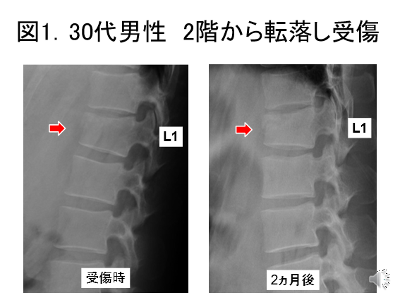 図１